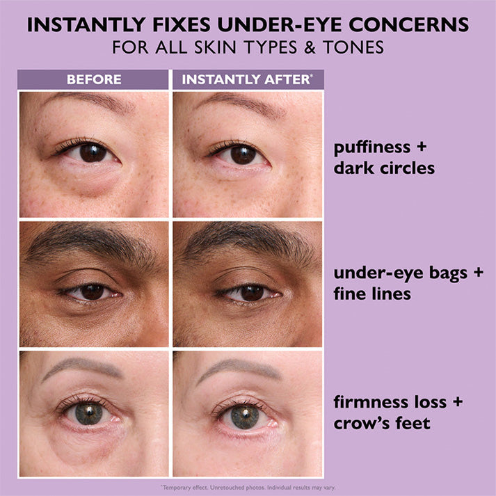 🌸Perfection Eye Tightener - EVQP® Instant Eye & Smooth Finish | Now with FREE Application Brush!!