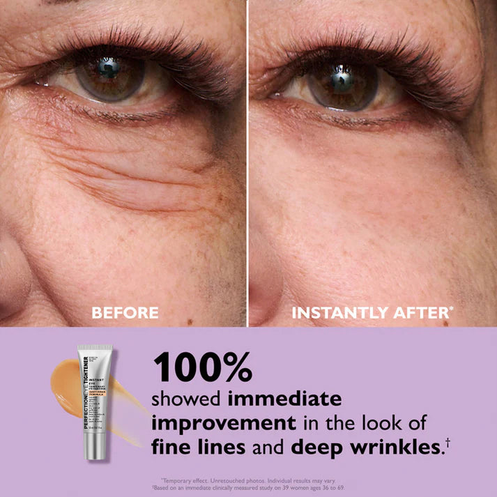 🌸Perfection Eye Tightener - Thonesr® Instant Eye & Smooth Finish | Now with FREE Application Brush!!