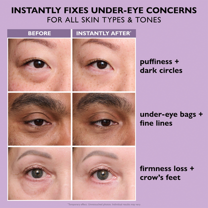 🌸Perfection Eye Tightener - Thonesr® Instant Eye & Smooth Finish | Now with FREE Application Brush!!